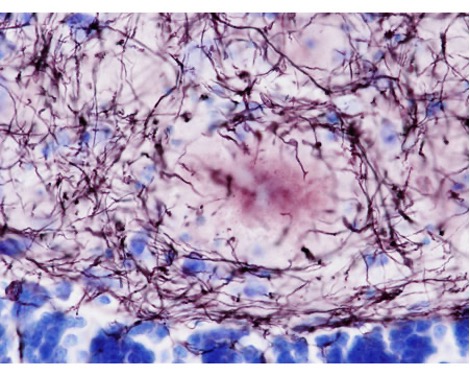 Fluoro-Jade C (FJC) Ready-to-Dilute Staining Kit for identifying  Degenerating Neurons