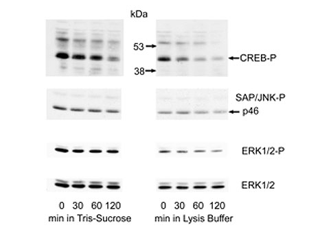 Western blots of Guinea pig brain stem inferior colliculi samples homogenized in Phospho-Sure RTD (B-100-PS) or Lysis buffer and kept on ice for up to 120 min. Aliquots of the homogenates (30 µg) were run on SDS-PAGE and proteins transferred to blotting membrane. Blots were stripped and incubated with 3 antibodies: CREB-P, SAP/JNK-P and ERK 1/2. Image courtesy of Suneja et al (2006).